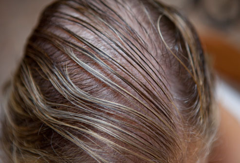 can vitamin d regrow hair